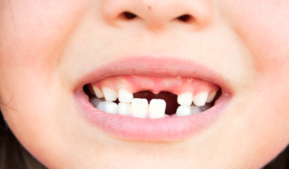 worrying-level-of-child-tooth-decay-the-exeter-daily